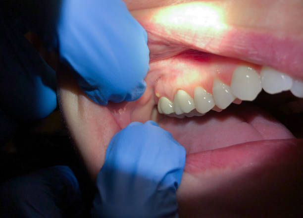 Best Cracked Tooth Emergency Dentist  in Hendersonville, NC